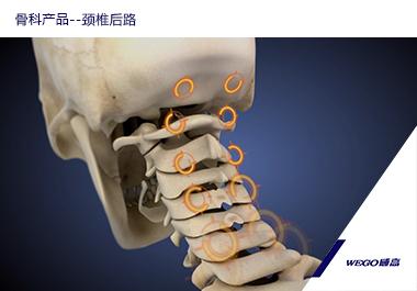 骨科产品--颈椎后路